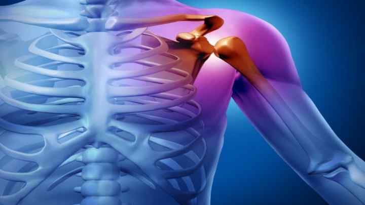 Адгезивний капсуліт плеча: симптоми, причини, стадії та особливості лікування