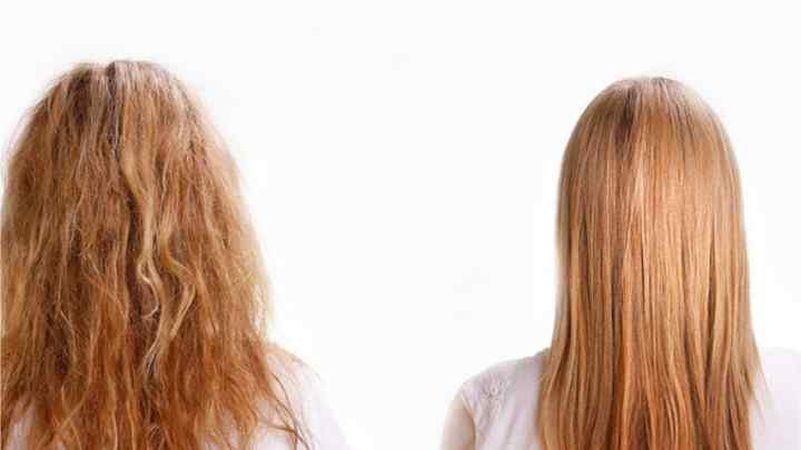 Лисіна у чоловіка: як можна відновити волосся