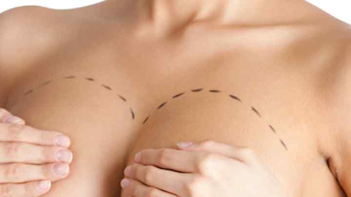 Як збільшити груди без операції
