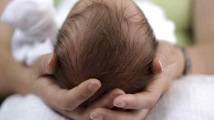 Кефалогематома у новонародженого на голові: причини та лікування