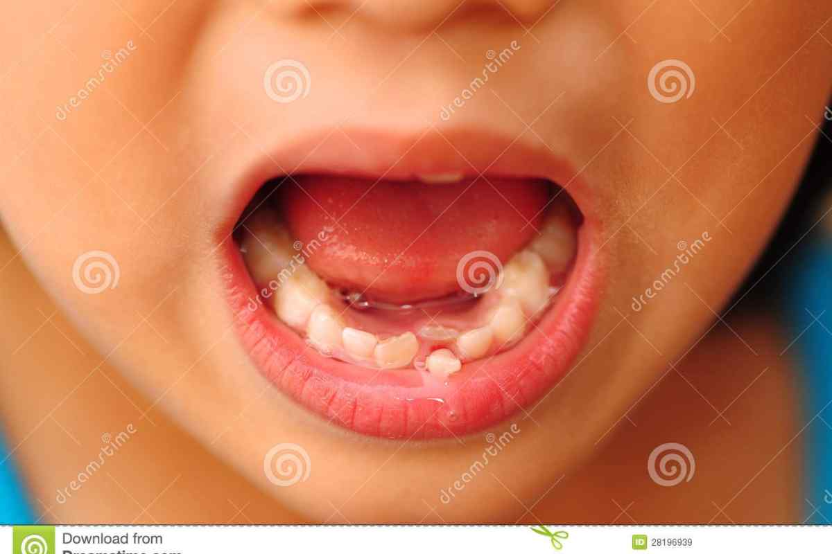 Як вирвати молочний зуб дитині