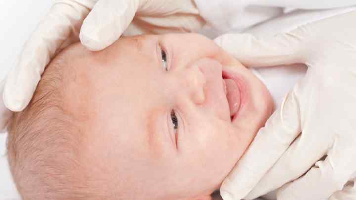 Як лікувати алергію новонароджених