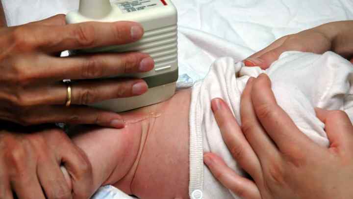 Дисплазія тазостегнових суглобів у новонароджених