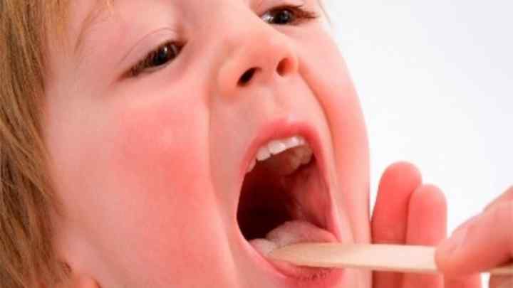 Чому дитина має запах з рота