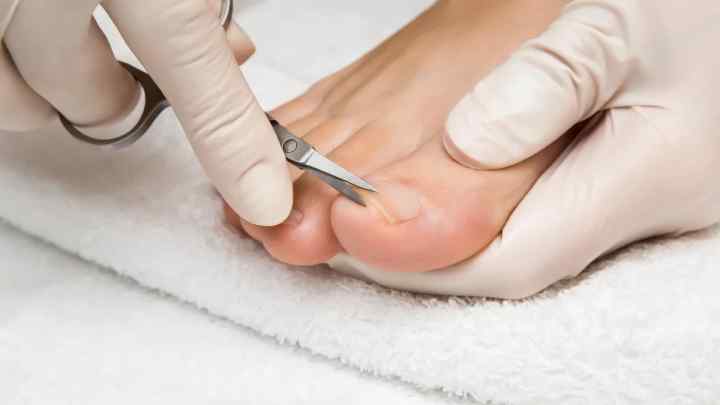 Гній на пальці ноги біля нігтя: причини, способи лікування