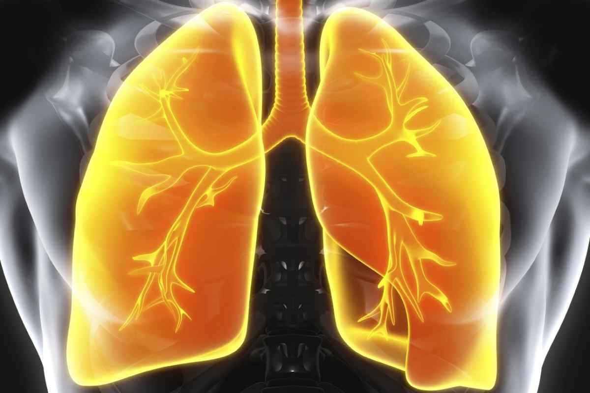 Цирротичний туберкульоз легенів: визначення, діагностування, причини, симптоми, лікування та профілактика захворювання
