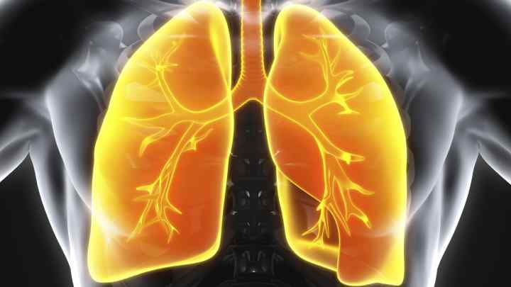 Цирротичний туберкульоз легенів: визначення, діагностування, причини, симптоми, лікування та профілактика захворювання