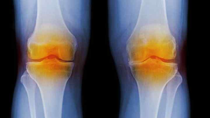 Що таке меніск колінного суглоба? Які бувають пошкодження і як їх діагностувати