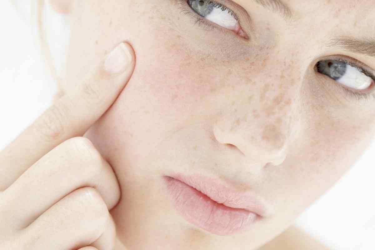 Висип на обличчі у жінок: причини та лікування