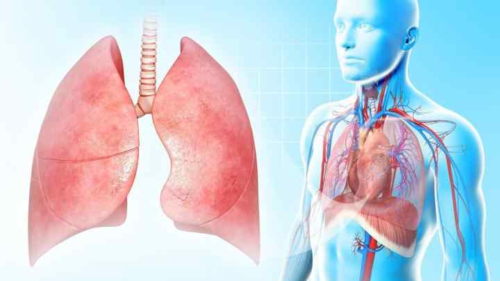 Чи можна ставити гірчичники при запаленні легенів? Чим лікувати запалення легенів