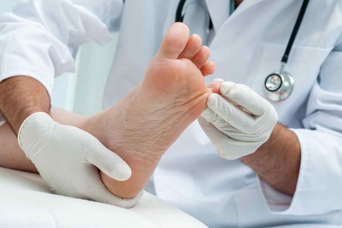 Який лікар лікує грибок нігтів на ногах - миколог чи дерматолог?