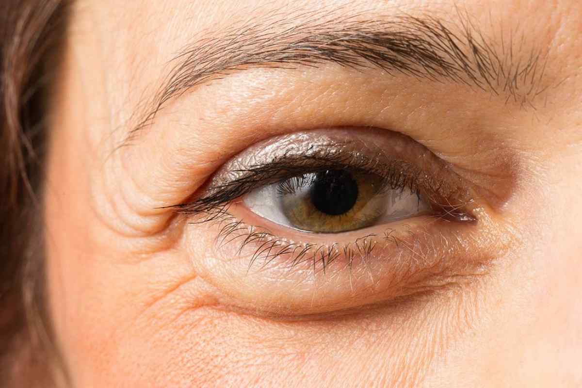 Як зняти набряк з очей після сліз: популярні та дієві методи