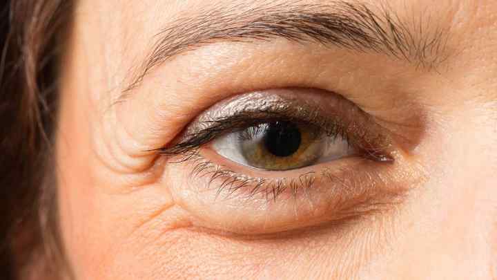 Як зняти набряк з очей після сліз: популярні та дієві методи