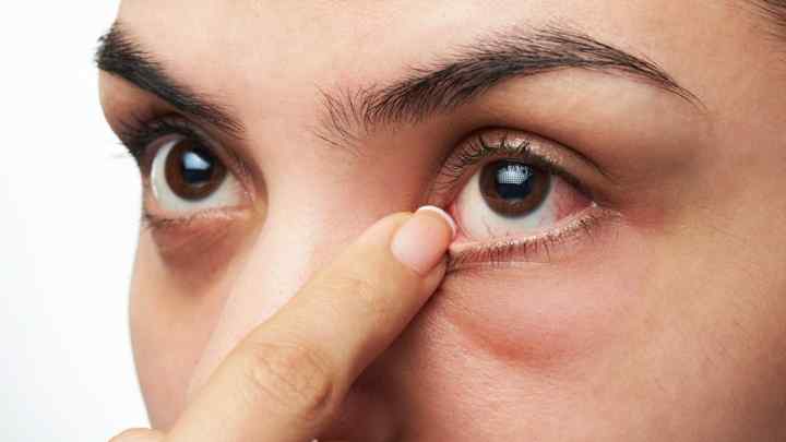 Плівка на оці у людини: причини та лікування