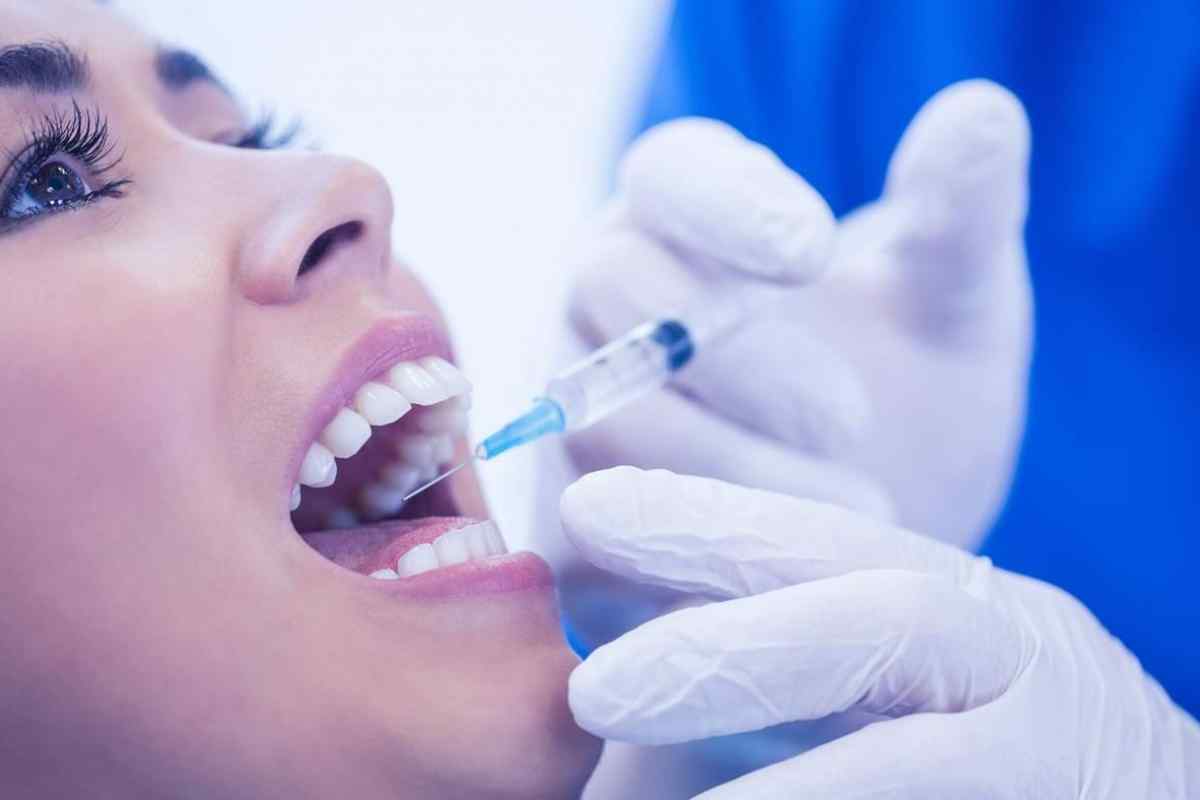 Анестезія інфільтраційна в стоматології