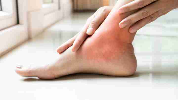 Артрит стопи ніг: лікування і причини появи