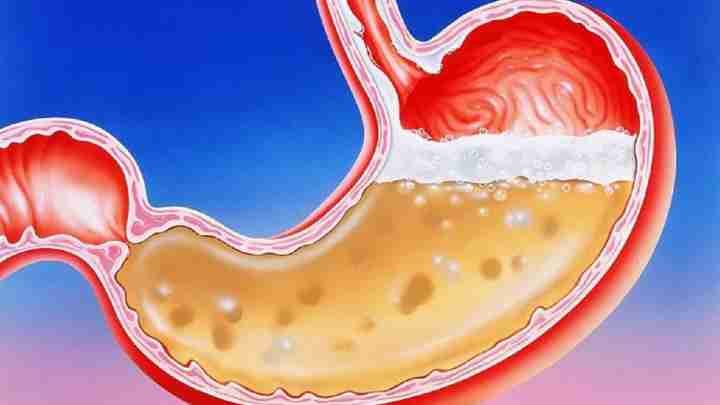 Ксантома шлунка: опис, причини, симптоми та особливості лікування
