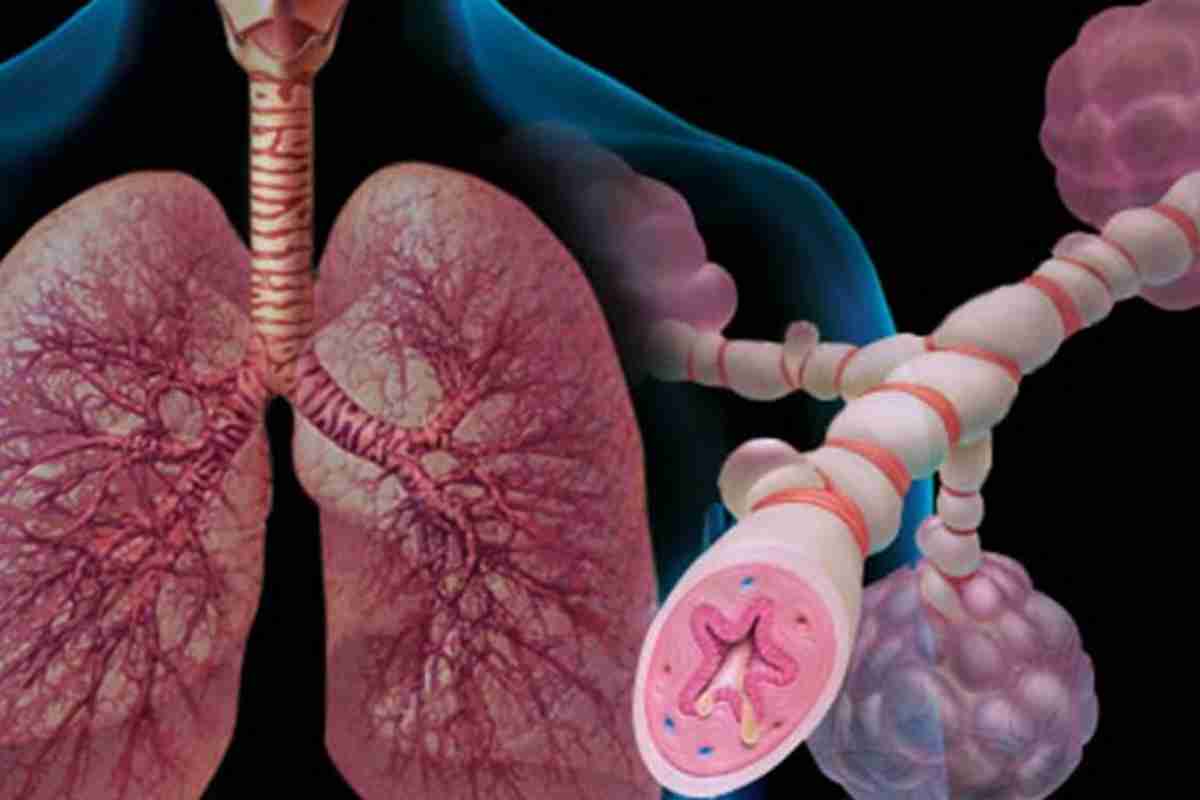 Лікується астма чи ні? Чи астма лікується повністю у дітей?