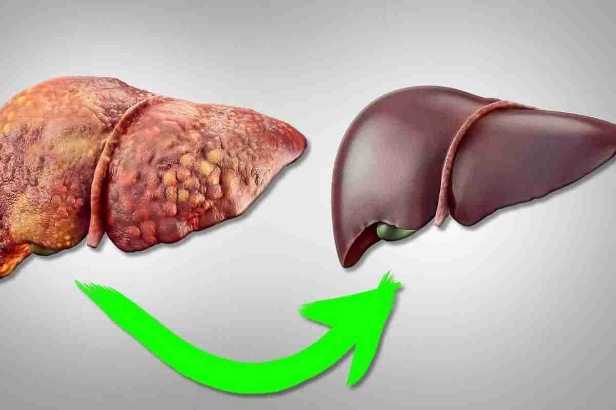При захворюванні печінки чи можна їсти печінку: корисні властивості, рекомендації фахівців та відгуки