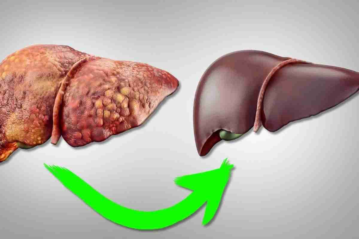Чим небезпечні кісти печінки, як лікувати захворювання