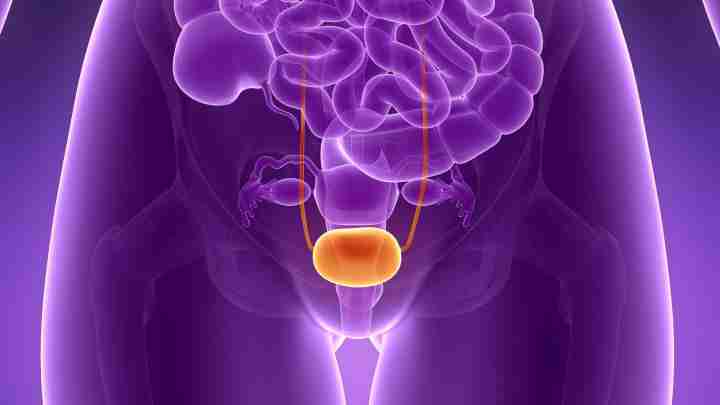 Поліп у сечовому міхурі у жінок: симптоми, причини та методи лікування