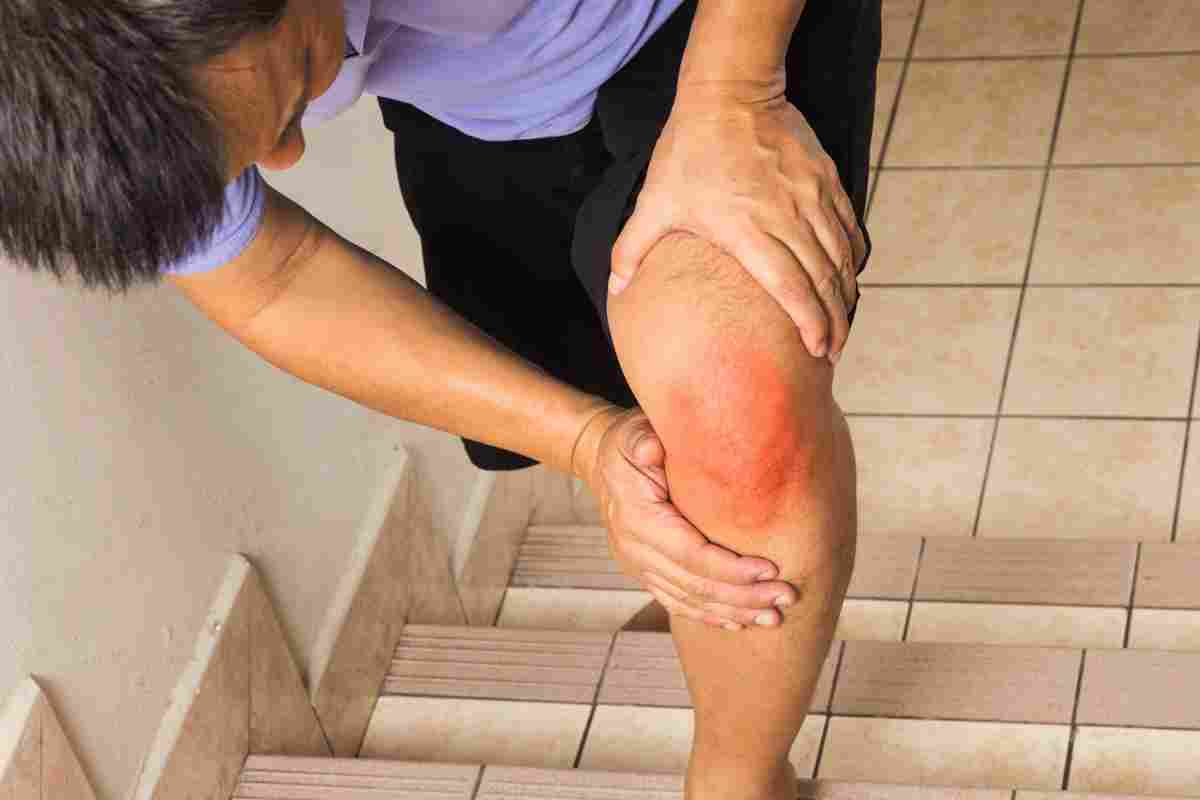 Вузлувата еритема на ногах: симптоми, причини, лікування