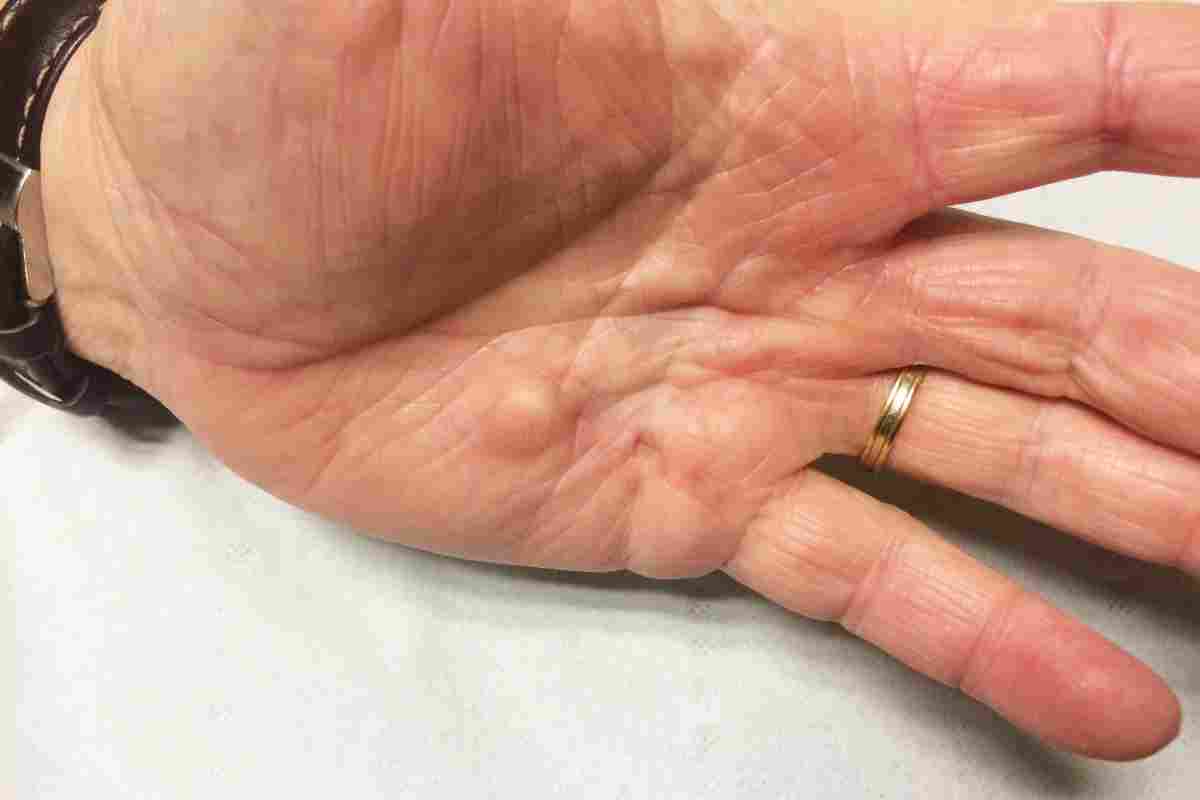 Самодіагностика по кистях рук і долонях