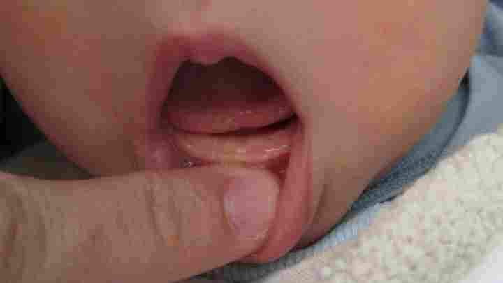 Перший зуб у дитини