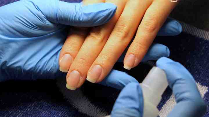 Який лікар лікує нігті