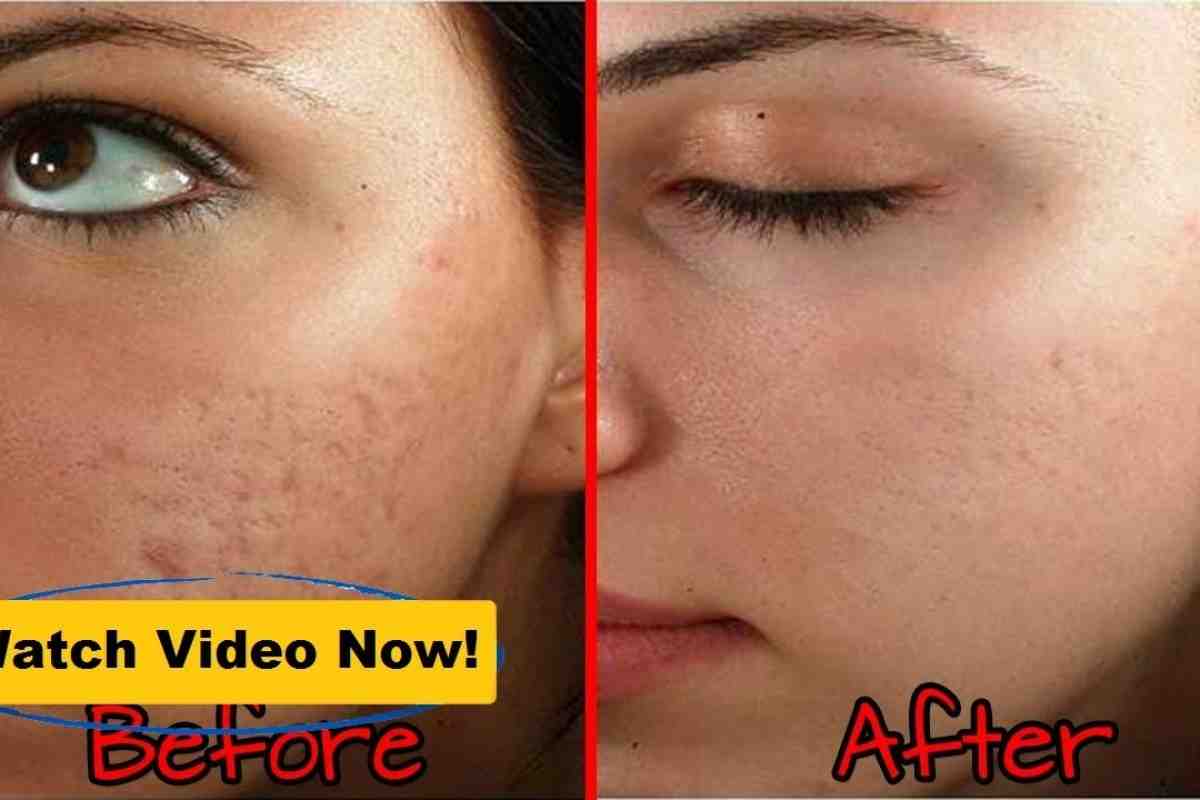 Як прибрати шрам на обличчі